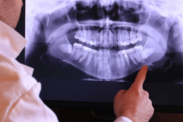 Best Dental Abscess Treatment in Hobart, IN